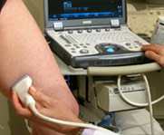 écho-doppler veineux chirurgie