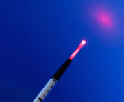 Endovenous laser (EVLT)